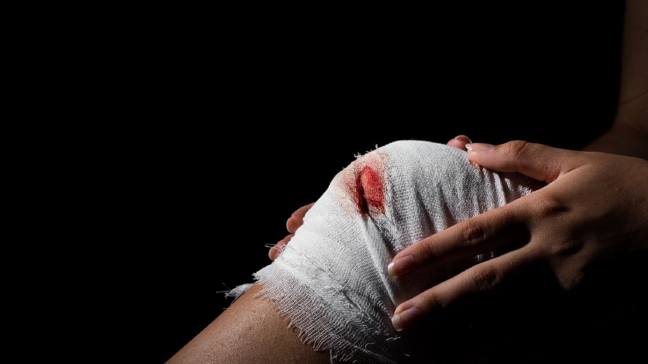 helpful tips on stopping bleeding